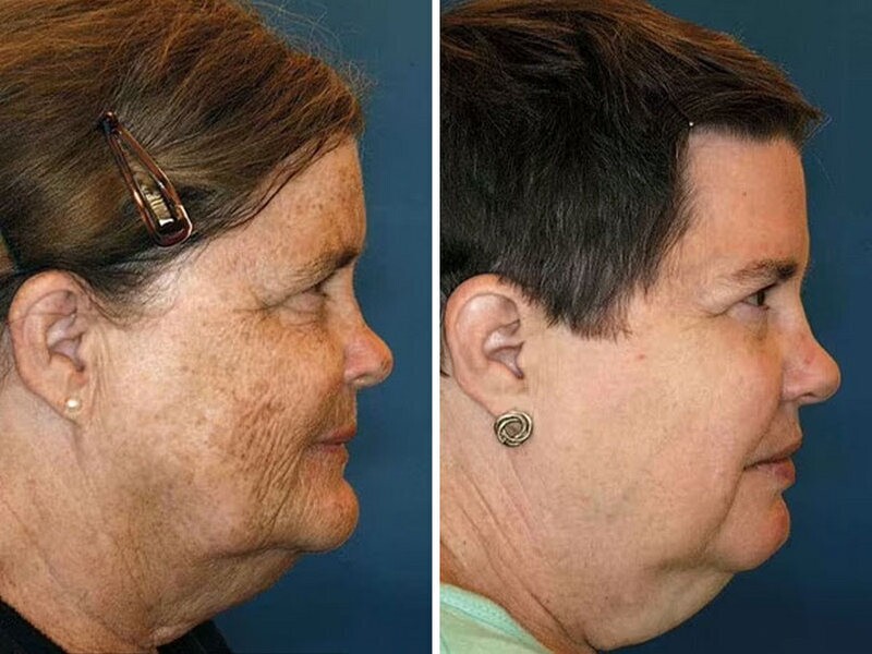 Солнечные лучи - прямая опасность для вашей кожи! 